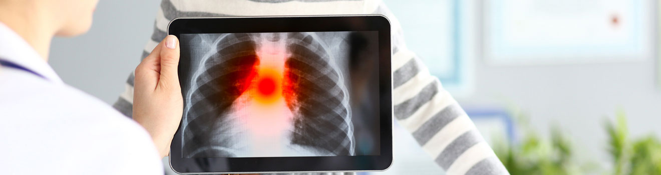 Pulmonology - Balaji Healthcare