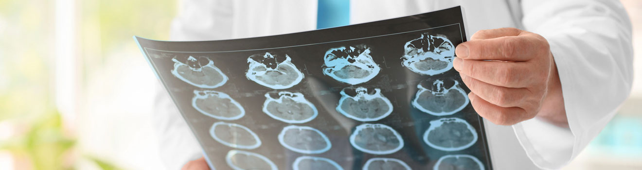 Neurology - Balaji Healthcare